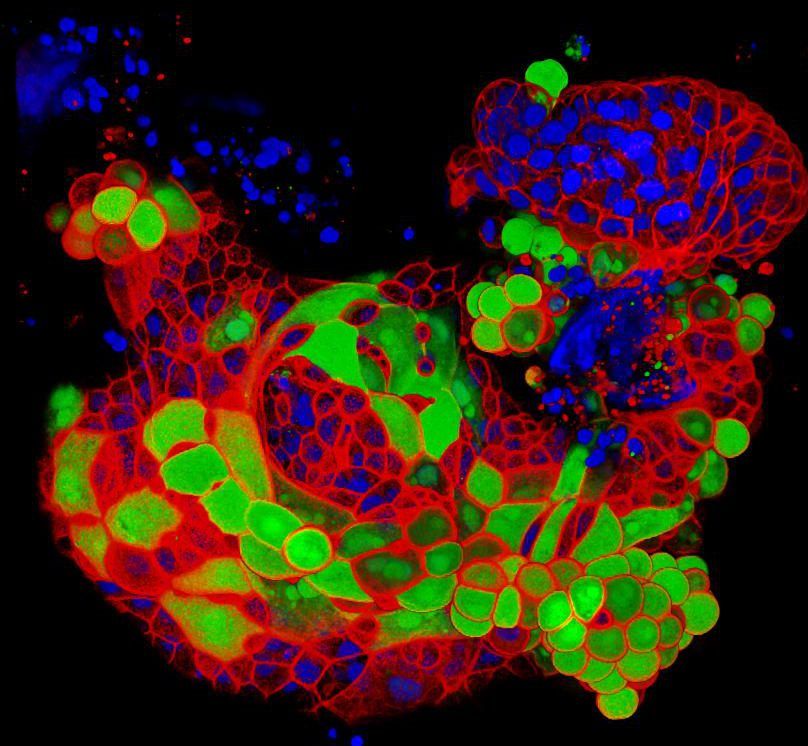 Organoid Group Adult Stem Cell Based Organoids Hubrecht Institute