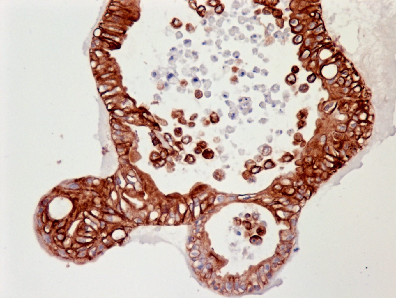 culturing-ovarian-cancer-organoids-hubrecht-institute