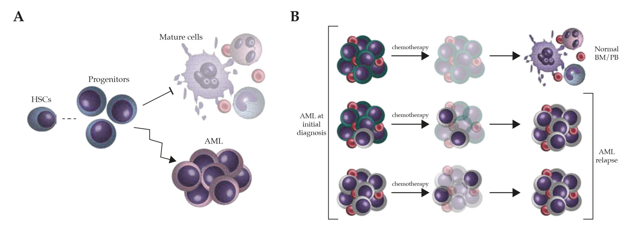 Acute Myeloid Leukemia Derived From Lympho Myeloid Clonal Hematopoiesis Hot Sex Picture