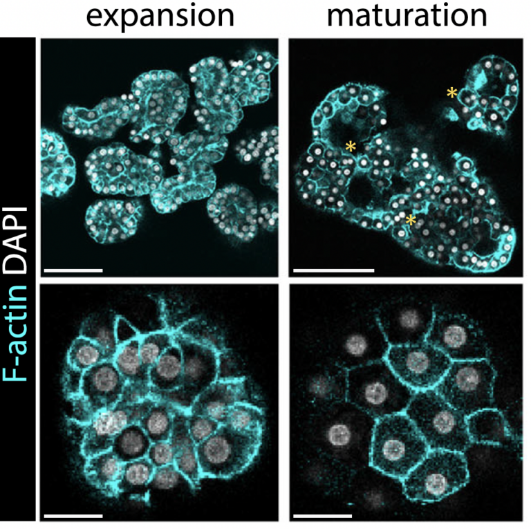 Microscopische foto van hepatocyt-organoïden, foetaal (links) en na rijping (rechts)