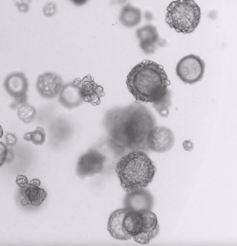 Microscopische afbeelding van volwassen hepatocyt-organoïden in kweek.