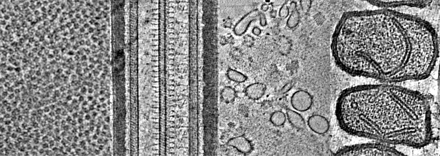 Cryo-electron tomography image showing examples of protein complexes and organelles in mammalian sperm.