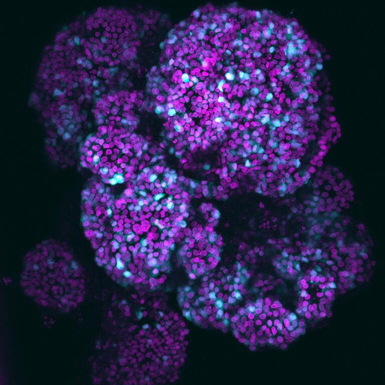 Microscopic photo of the pancreas organoid. In magenta you can see the nuclei of the cells and in Cyan you can see the acinar cells that secrete digestive enzymes.